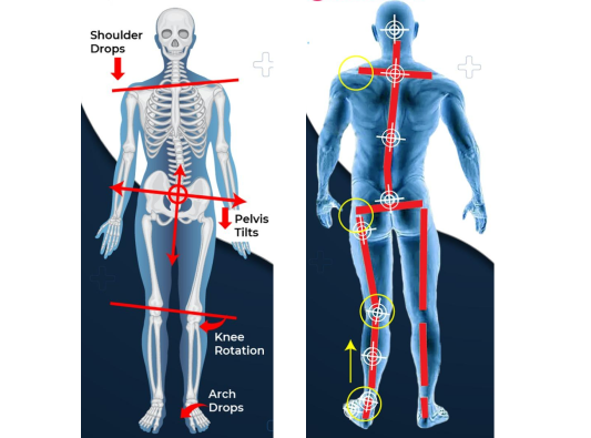 Posture Comparison - Good vs Poor Posture