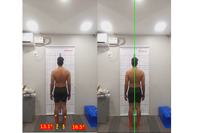 Customized Rehab Program